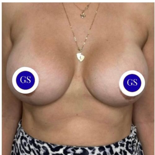 Collage-mastopessi-Napoli-1536x751 copia