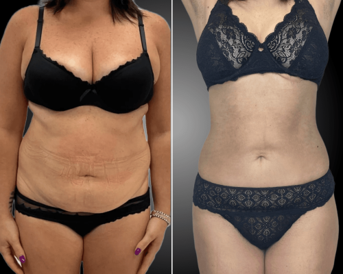 png_20230525_104852_0000