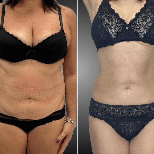 png_20230525_104852_0000