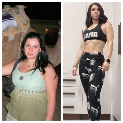 chiurgia bariatrica napoli